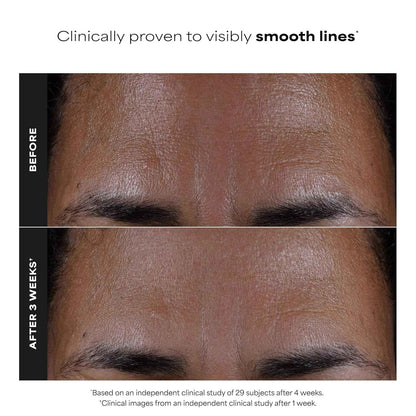 Paula's Choice SKIN PERFECTING 2% BHA Salicylic Acid Exfoliating Pads - Facial Exfoliant Pads for Blackheads, Enlarged Pores, Wrinkles & Fine Lines