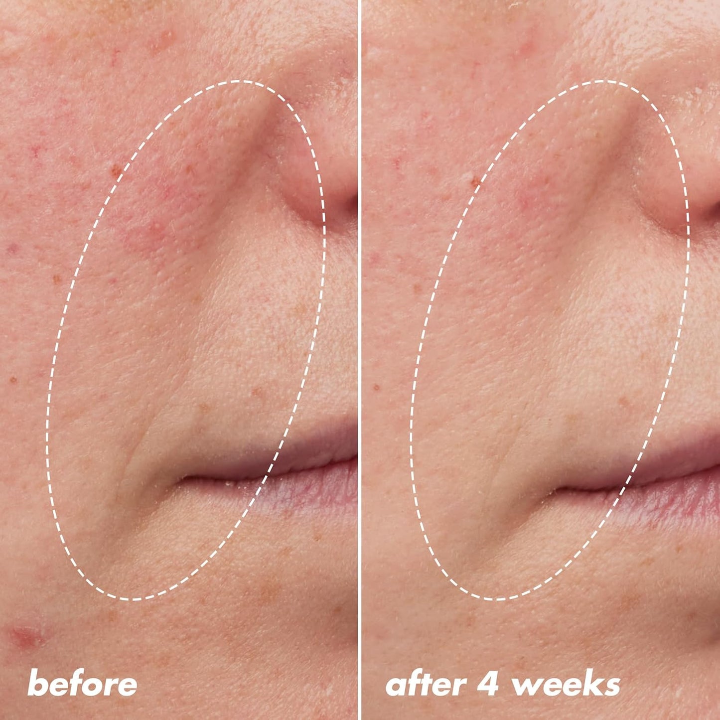 e.l.f._SKIN_Youth_Boosting_Blue-ty_Sleep_Night_Oil,_Gentle_Overnight_Face_Oil,_Treats_Fine_Lines_&_Uneven_Texture,_Lightweight,_Vegan_&_Cruelty-Free