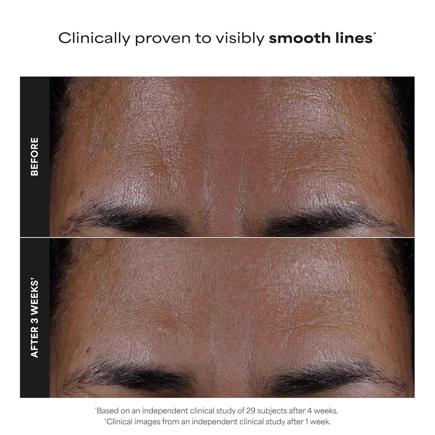 Paula's Choice SKIN PERFECTING 2% BHA Liquid Exfoliant with Salicylic Acid, Facial Polish for Pores, Wrinkles & Fine Lines, Suitable for Blackhead-Prone Skin, Fragrance-Free