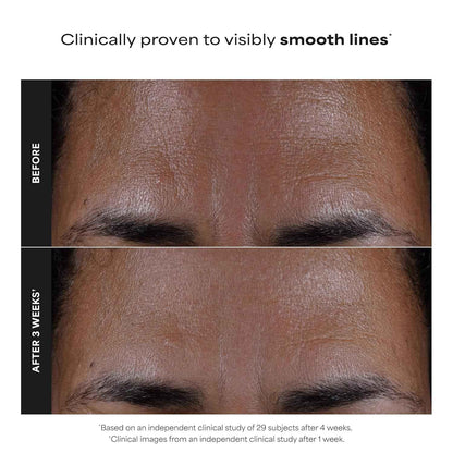 Paula's Choice SKIN PERFECTING 2% BHA Liquid Exfoliant with Salicylic Acid, Facial Polish for Pores, Wrinkles & Fine Lines, Suitable for Blackhead-Prone Skin, Fragrance-Free
