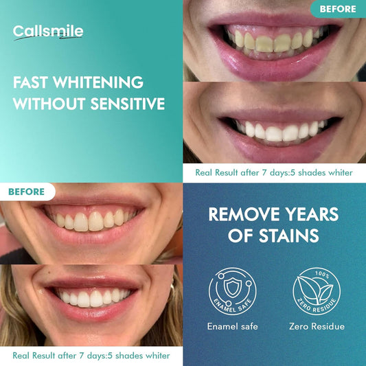 CALLSMILE_Whitening_Strips_for_Sensitive_Teeth:_16_Treatments_Gentle_Whitening_|_Enamel-Safe_|_Deep_Stains_Removal_|_Non-Slip_Dry_Strips_Daily_Oral_Care,_Mint_Sea_Salt