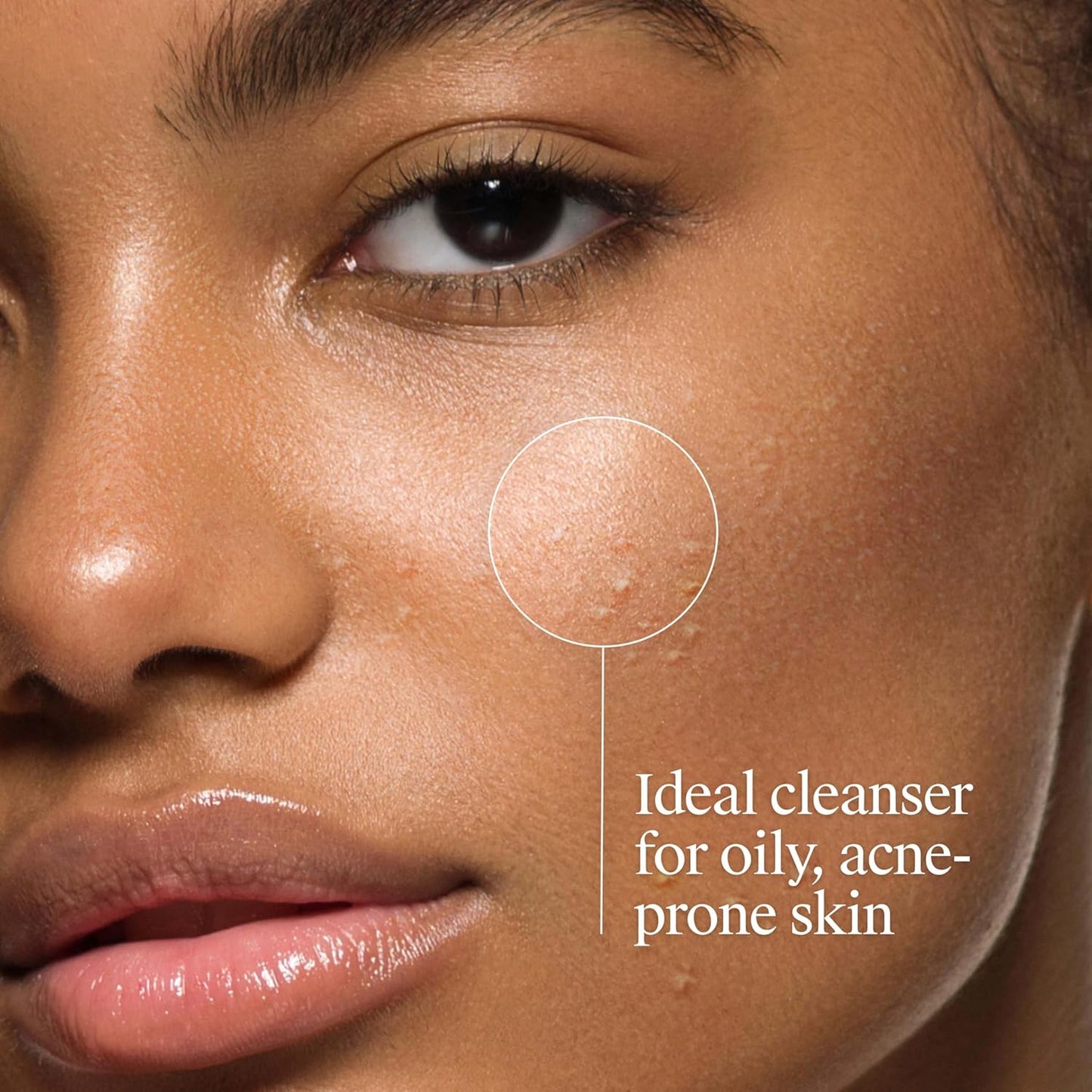 Neutrogena_Oil-Free_Acne_Face_Wash_-_Facial_Cleanser_with_Salicylic_Acid,_Daily_Cleanser_for_Oily_&_Acne-Prone_Skin,_Clears_&_Helps_Prevent_Breakouts,_Clear_Formula,_9.1_fl._oz._Bottle