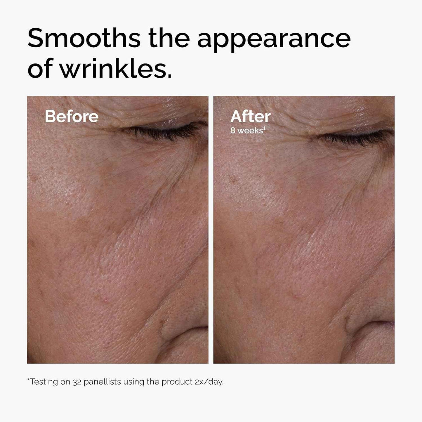 The Ordinary Multi-Peptide + Hyaluronic Acid, Anti-Aging Peptide Serum for Crow’s Feet, Elasticity & Firmness, 1 Fl Oz