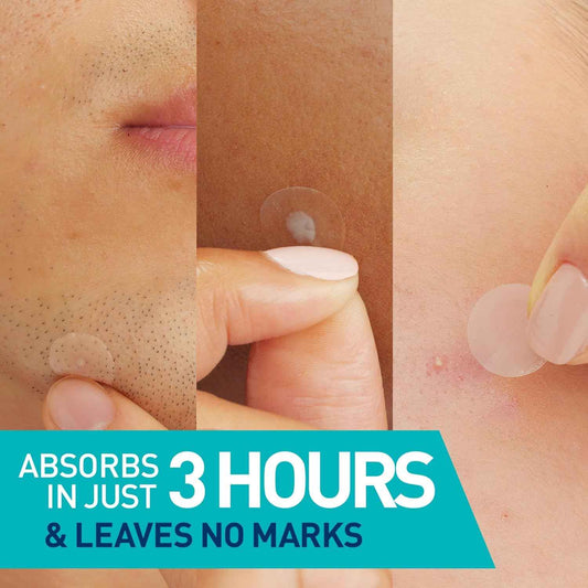 CeraVe Blemish Barrier Patches for Acne-Prone & Sensitive Skin, Hydrocolloid Pimple Patches with Ceramides & Niacinamide, Ultra-Thin, Oil-Absorbing, Blends with All Skin Tones, Allergy-Tested