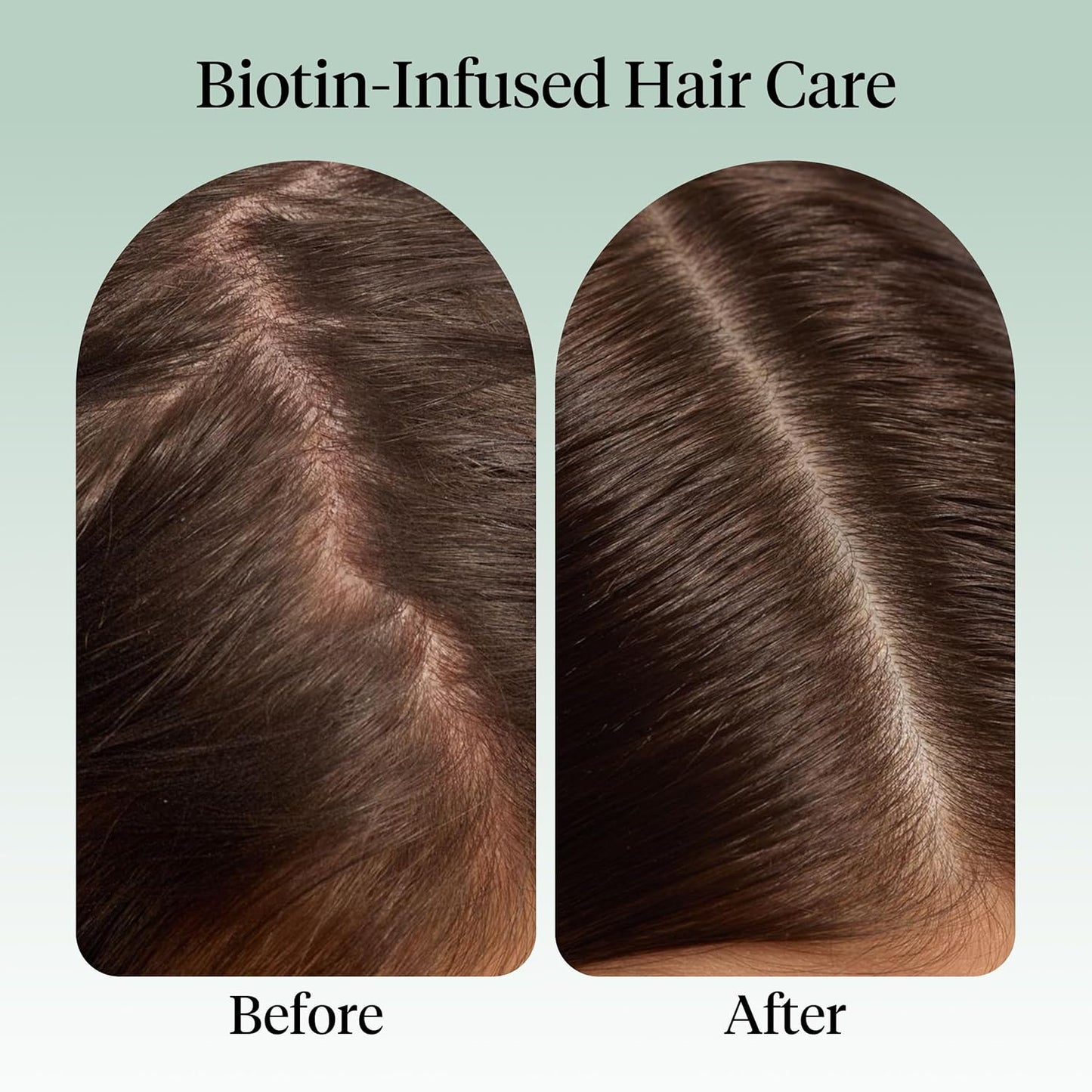 Kitsch_Rosemary_Oil_for_Hair_Growth_–_Hair_Oil_with_Biotin,_Castor_&_Jojoba_–_Pre-Wash_Scalp_oil_for_Hair_Care_–_Lavender_Scent_–_10mL_|_Ideal_Gifts_for_Women