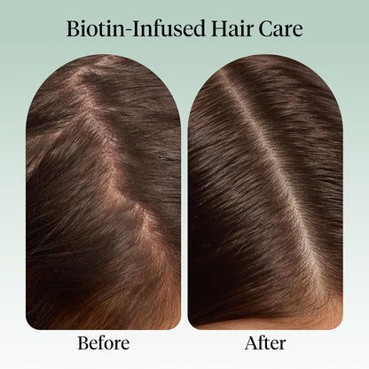 Kitsch_Rosemary_Oil_for_Hair_Growth_–_Hair_Oil_with_Biotin,_Castor_&_Jojoba_–_Pre-Wash_Scalp_oil_for_Hair_Care_–_Lavender_Scent_–_10mL_|_Ideal_Gifts_for_Women