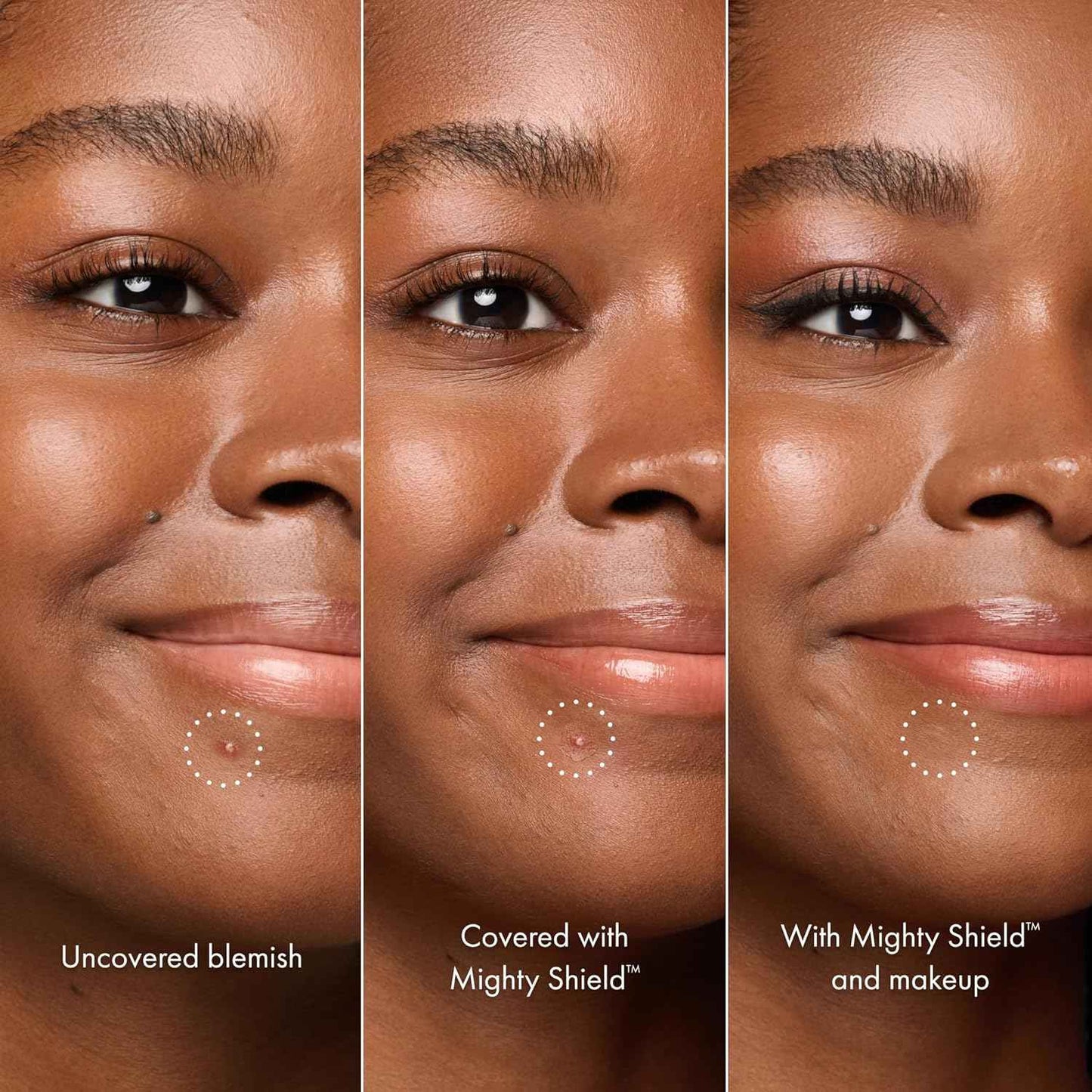 HERO COSMETICS Mighty Shield™ Liquid Patch Invisible Blemish Protectant for Pimples, Zits, and Blemish Wounds. Fast-Drying and Protects Blemishes from Makeup, Sunscreen
