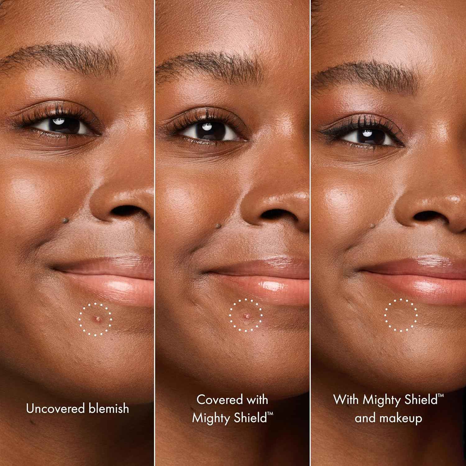 HERO COSMETICS Mighty Shield™ Liquid Patch Invisible Blemish Protectant for Pimples, Zits, and Blemish Wounds. Fast-Drying and Protects Blemishes from Makeup, Sunscreen