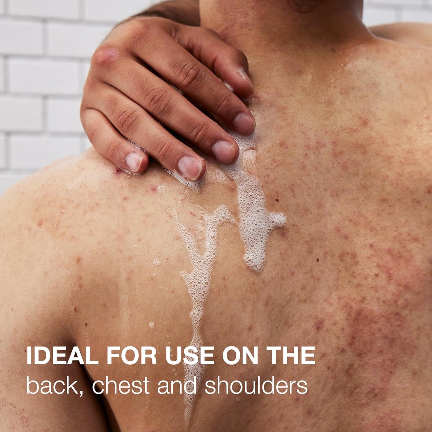 Neutrogena_Salicylic_Acid_&_PHA_Stubborn_Acne_Body_Wash,_Exfoliating_Cleanser_Acne_Treatment_for_Chest_&_Shoulder,_Gently_Clears,_Exfoliates_&_Helps_Prevent_Breakouts,_Fragrance_Free,_8.5_Fl_Oz