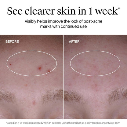 Neutrogena_Evenly_Clear_Acne_Cleanser_with_2%_Salicylic_Acid_&_2%_PHA_Exfoliant,_Gentle_Foaming_Face_Wash_Clears_Clogged_Pores_&_Blackheads_While_Visibly_Fading_Look_of_Post-Acne_Marks,_9.1_fl._oz