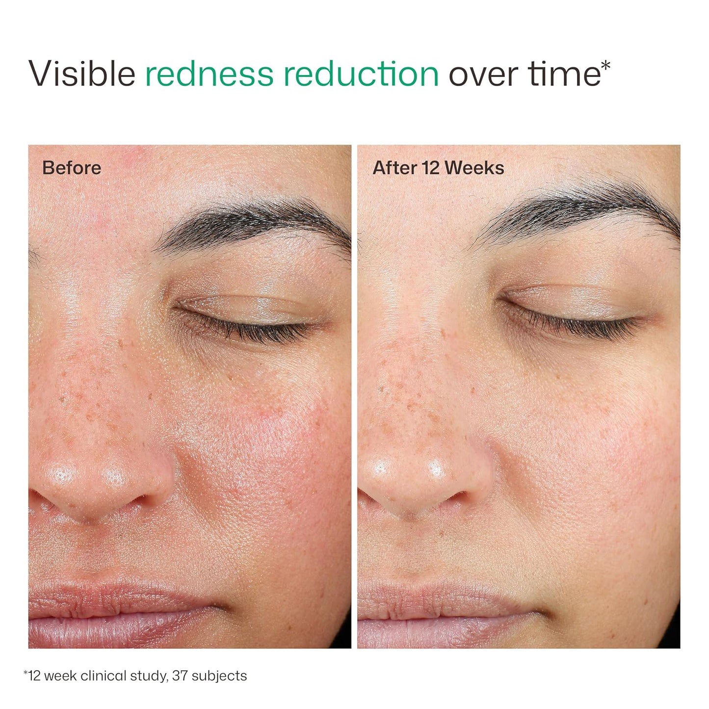 EltaMD_UV_Skin_Recovery_Face_Sunscreen_with_Zinc_Oxide,_All_Mineral,_Safe_for_Sensitive_Skin_SPF_50