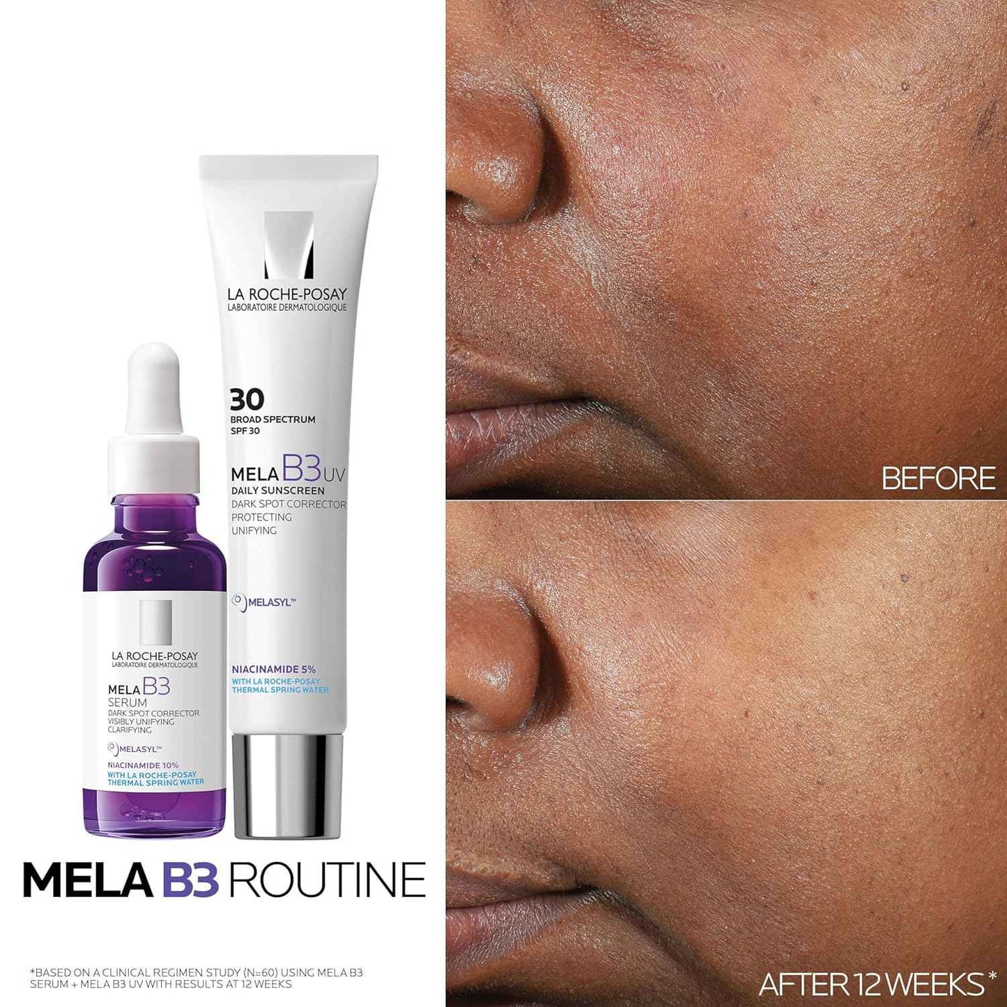 La Roche-Posay Mela B3 UV Daily Sunscreen, Face Moisturizer With SPF 30 + Anti-Aging Melasyl + 5% Niacinamide, Helps Correct & Protect From Sun Damage, Face Sunscreen With No White Cast, 40ML
