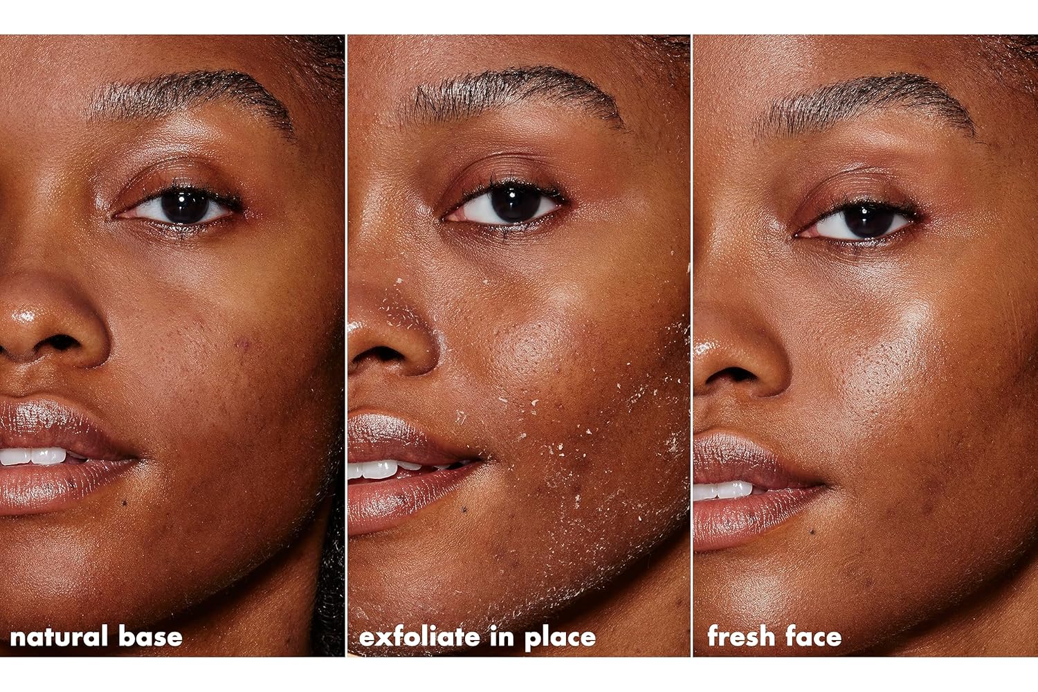 e.l.f._SKIN_Gentle_Peeling_Exfoliant,_Cleanser,_Effective,_Easy_to_Apply,_Peels_Away_Dead_Skin,_Removes_Dirt,_Ideal_for_All_Skin_Types