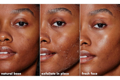 e.l.f._SKIN_Gentle_Peeling_Exfoliant,_Cleanser,_Effective,_Easy_to_Apply,_Peels_Away_Dead_Skin,_Removes_Dirt,_Ideal_for_All_Skin_Types