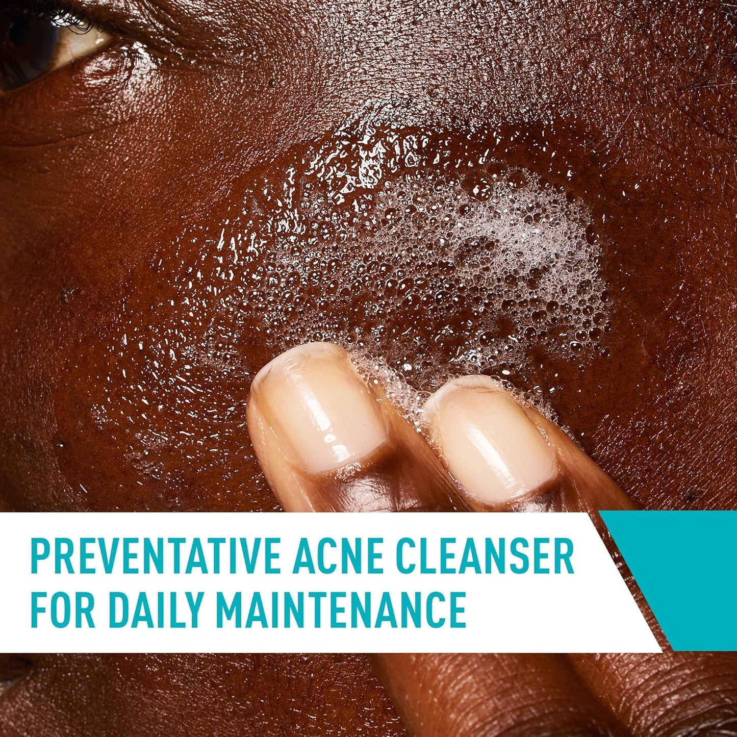 CeraVe_Acne_Treatment_Face_Wash,_Salicylic_Acid_Cleanser_with_Purifying_Clay,_Niacinamide,_and_Ceramides,_Pore_Control_and_Blackhead_Remover,_8_Ounce