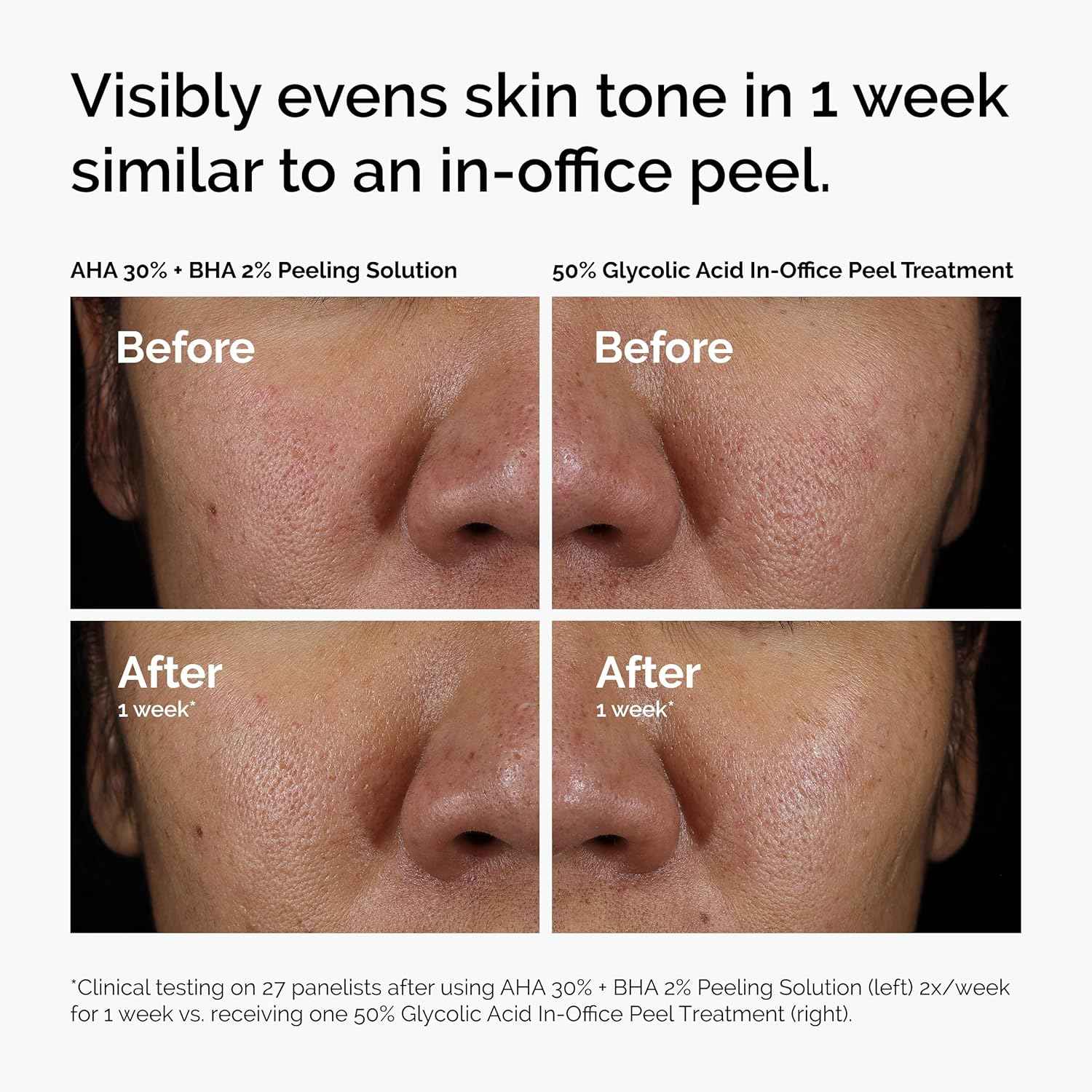 The Ordinary, Advanced Exfoliating Peel for Brighter Skin