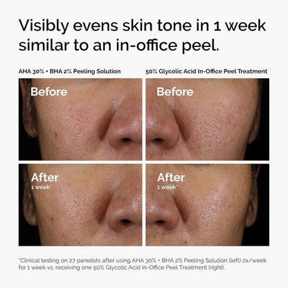 The Ordinary, Advanced Exfoliating Peel for Brighter Skin