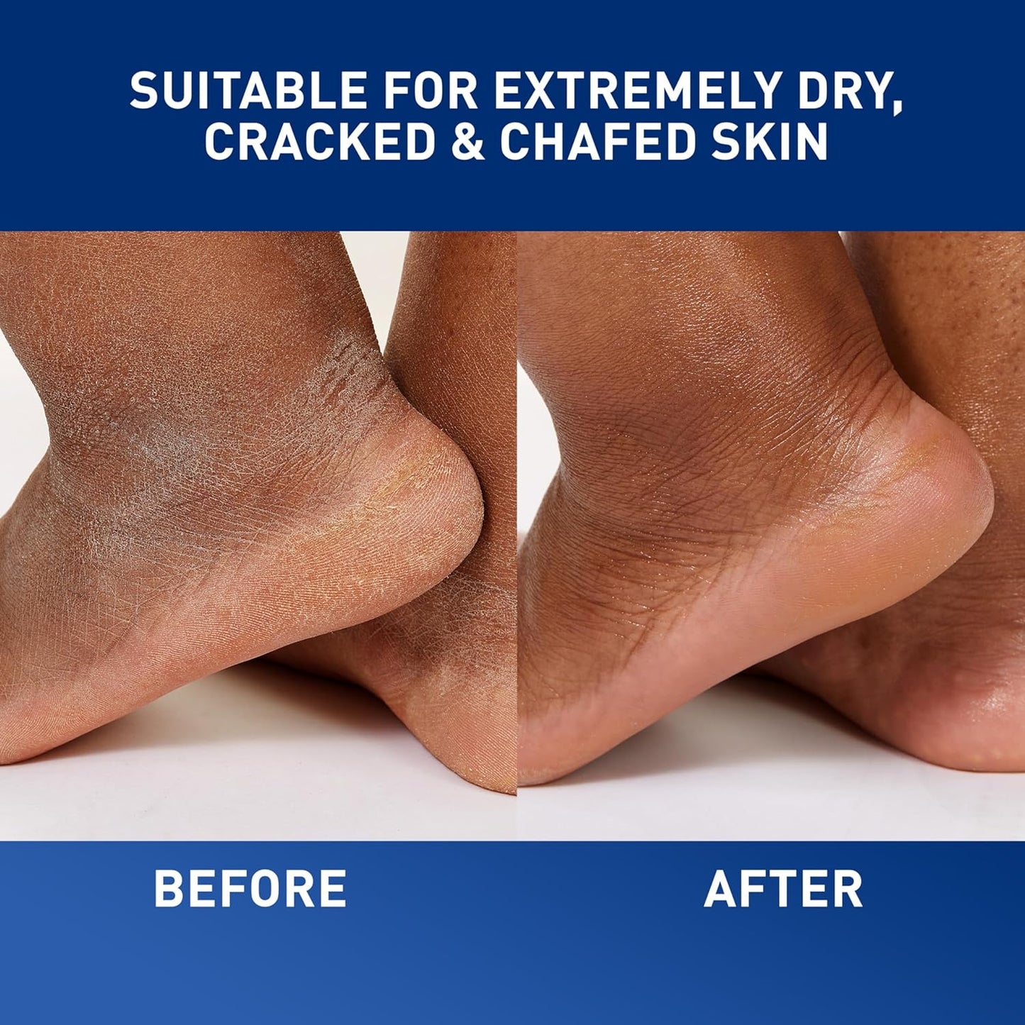 CeraVe_Healing_Ointment,_Hydrating_Skin_Protectant_With_Petrolatum,_Hyaluronic_Acid_&_Ceramides,_Face_&_Body_Skin_Barrier_Repair_For_Cracked,_Chafed,_Dry_Skin,_Fragrance_Free_&_Lanolin_Free,_12_Oz