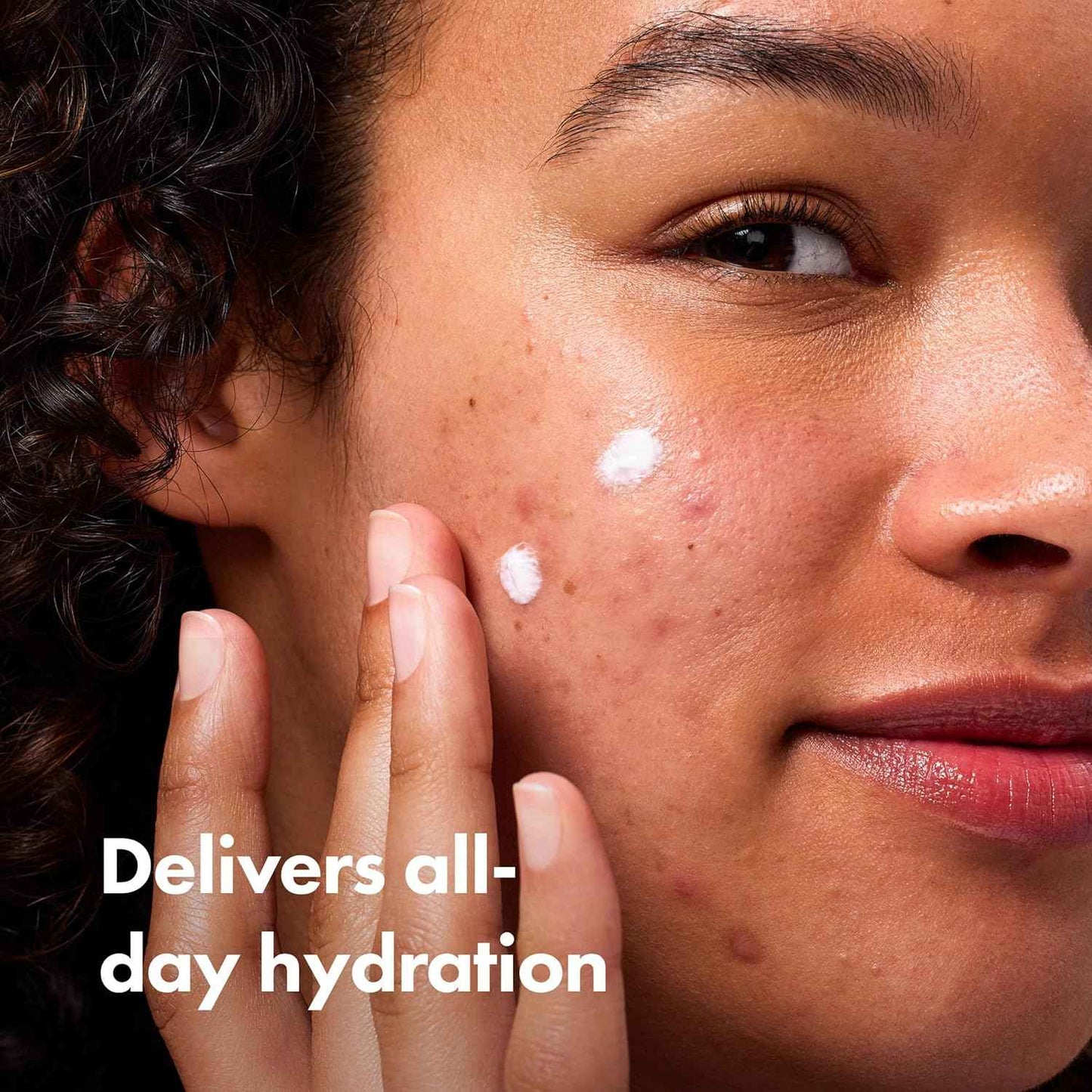 Hero Cosmetics Rescue Balm (New Formula)-The Post-Blemish Cream to Boost Hydration and Improve the Look of Post-Blemish Marks. Derm-Tested. New Formula. Won’t Clog Pores. 15mL