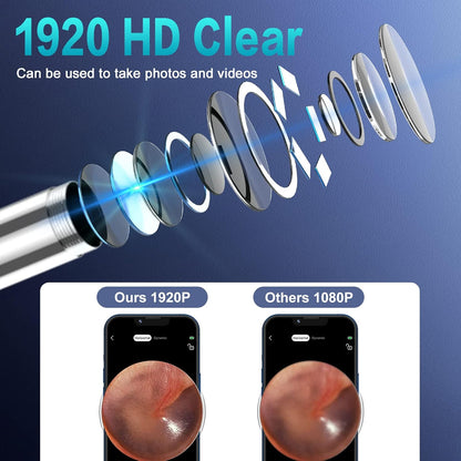 Ear_Wax_Removal_Kit_1920P_HD,_WiFi_Ear_Cleaner_Camera_Diameter_3mm,_Earwax_Remover_Tool_with_6_Ear_Spoon,_Ear_Camera_with_8_Pcs_Ear_Set,_Earwax_Camera_Cleaner_for_iOS_and_Android
