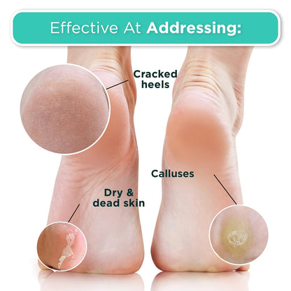 Foot_Peel_Mask_-_2_Pack_of_Regular_Skin_Exfoliating_Foot_Masks_for_Dry,_Cracked_Feet,_Callus,_Dead_Skin_Remover_-_Feet_Peeling_Mask_for_Soft_Feet