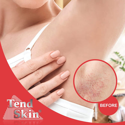 Tend_Skin_Womens_AfterShave/Post_Waxing_Solution_for_Ingrown_Hair,_Razor_Bumps_and_Burns,_4_ounce,_Blue