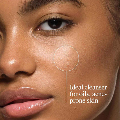 Neutrogena Oil-Free Acne Face Wash – Daily Skincare Ritual for Breakout-Prone Skin, 2% Salicylic Acid Cleanser, 6 fl. oz