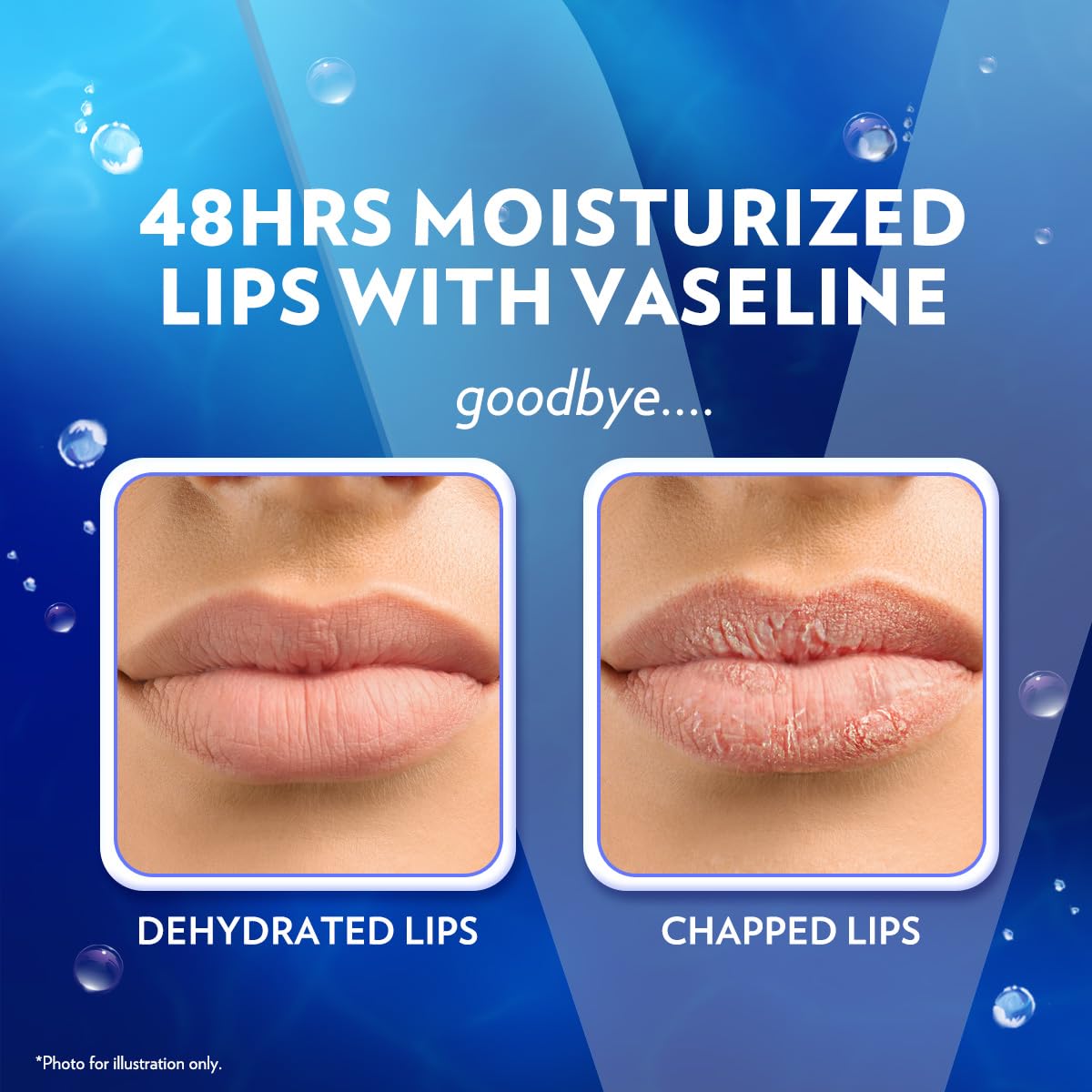 Vaseline Lip Therapy Original Care – Bedside Nightly Lip Hydration Ritual, 12-Pack Multi-Pack for Daily Self-Care