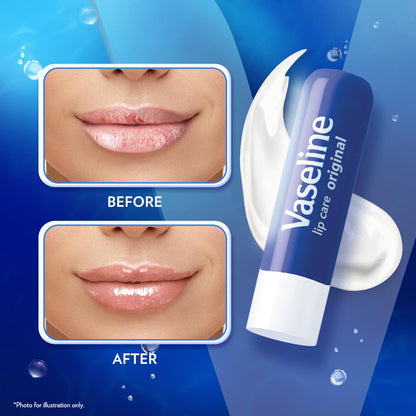 Vaseline Lip Therapy Original Care – Bedside Nightly Lip Hydration Ritual, 12-Pack Multi-Pack for Daily Self-Care
